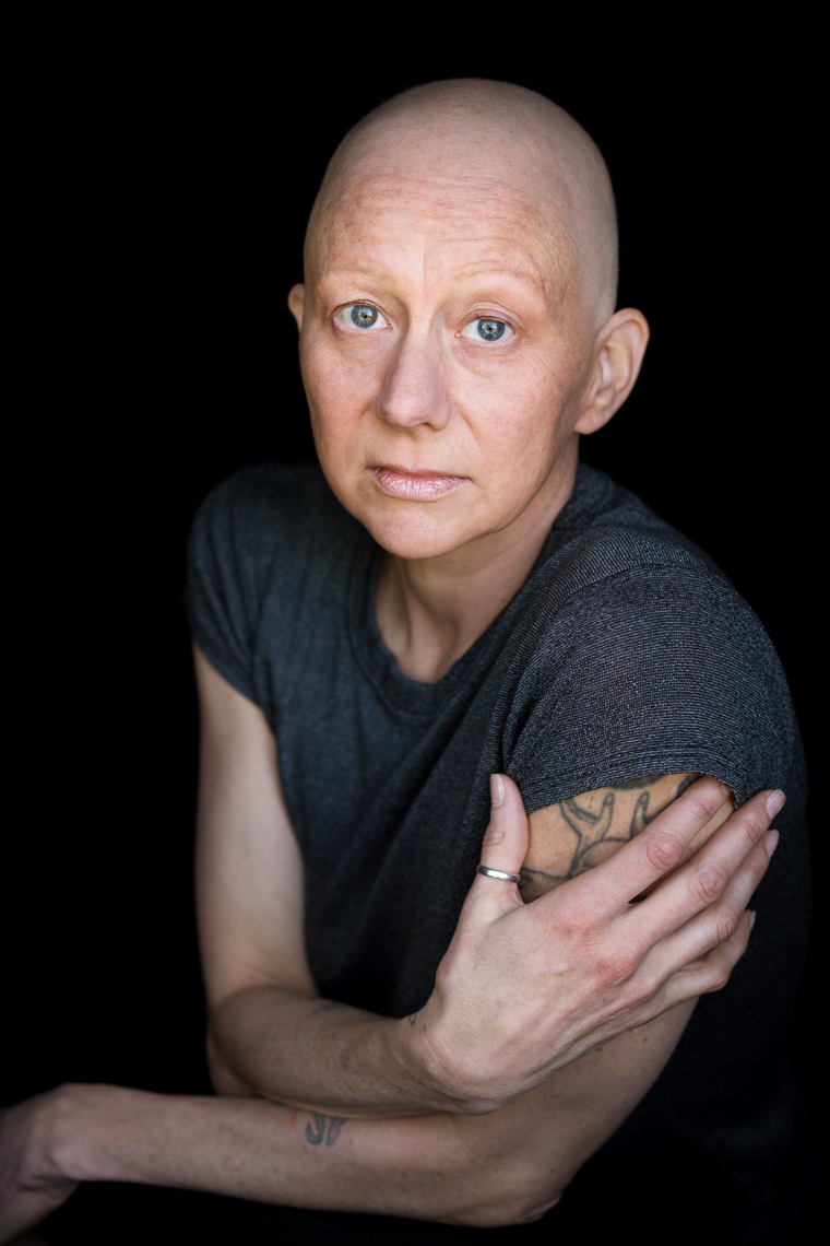 Facing Chemo - a photographic exhibit examing the effects of chemotherapy by healthcare photographer Robert Houser