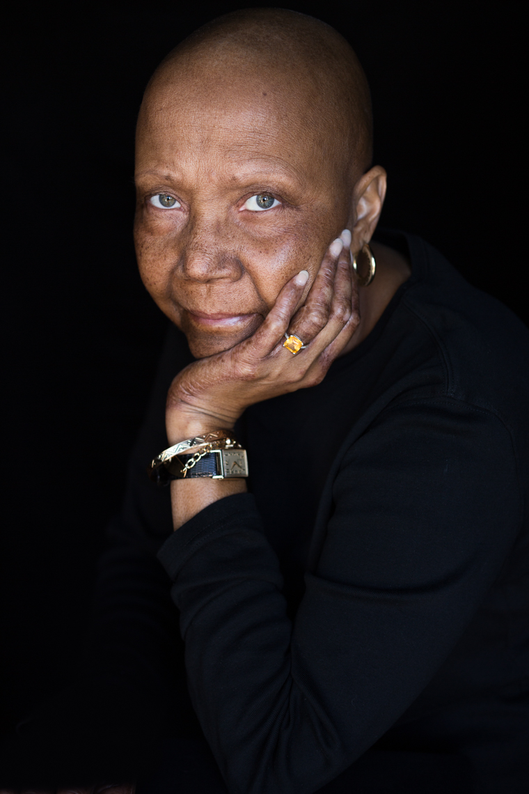 Facing Chemo is a photographic project for the Facing Light Foundation photographed by health and wellness photographer Robert Houser 