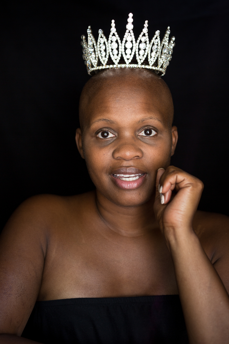 Facing Chemo - a photographic exhibit examing the effects of chemotherapy - by healthcare photographer Robert Houser