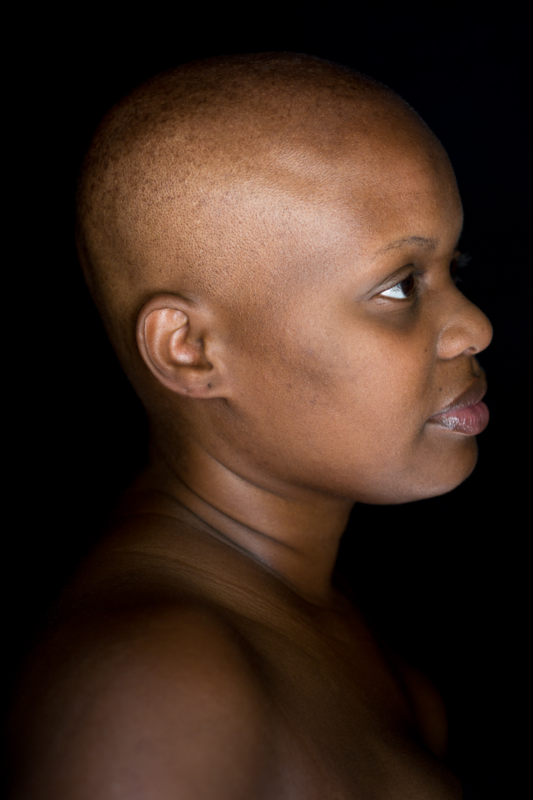 Facing Chemo - a photographic exhibit examing the effects of chemotherapy - by healthcare photographer Robert Houser