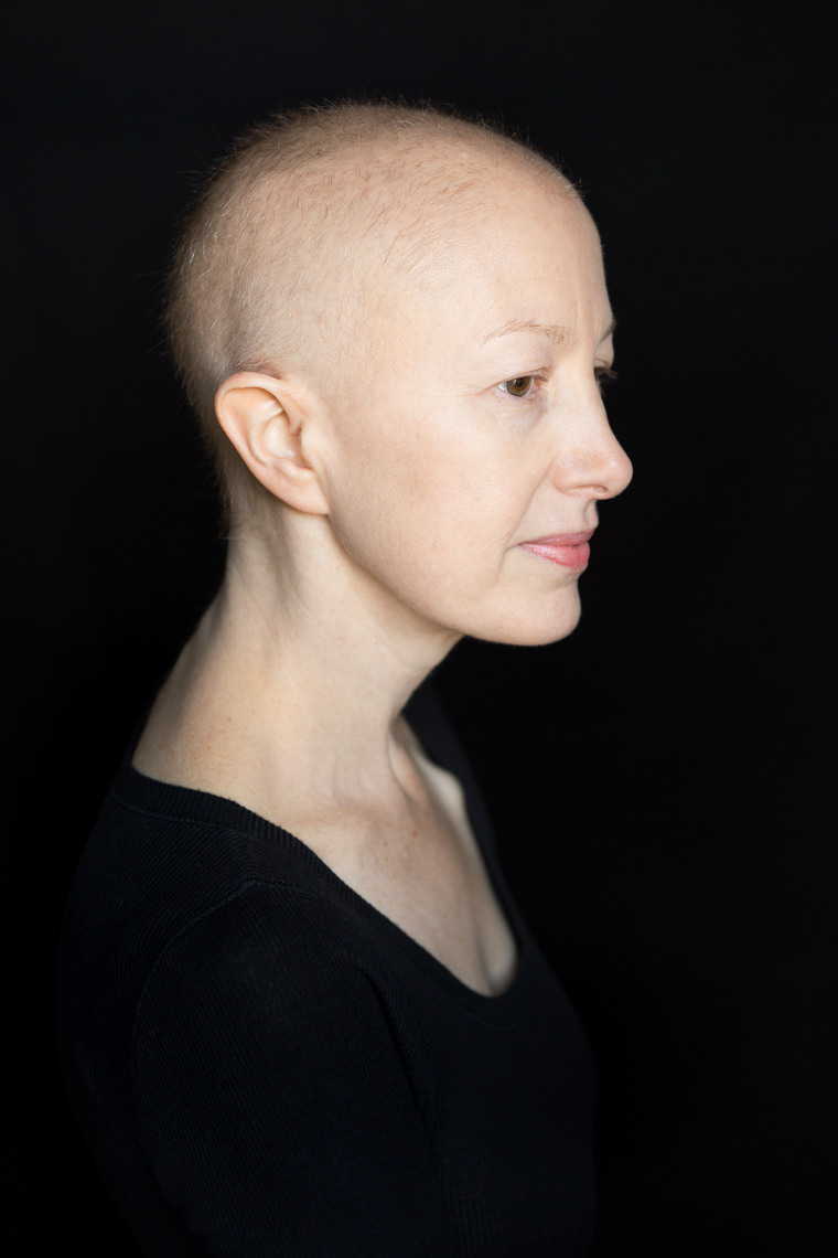 Facing Chemo - a photographic exhibit examing the effects of chemotherapy - by healthcare photographer Robert Houser