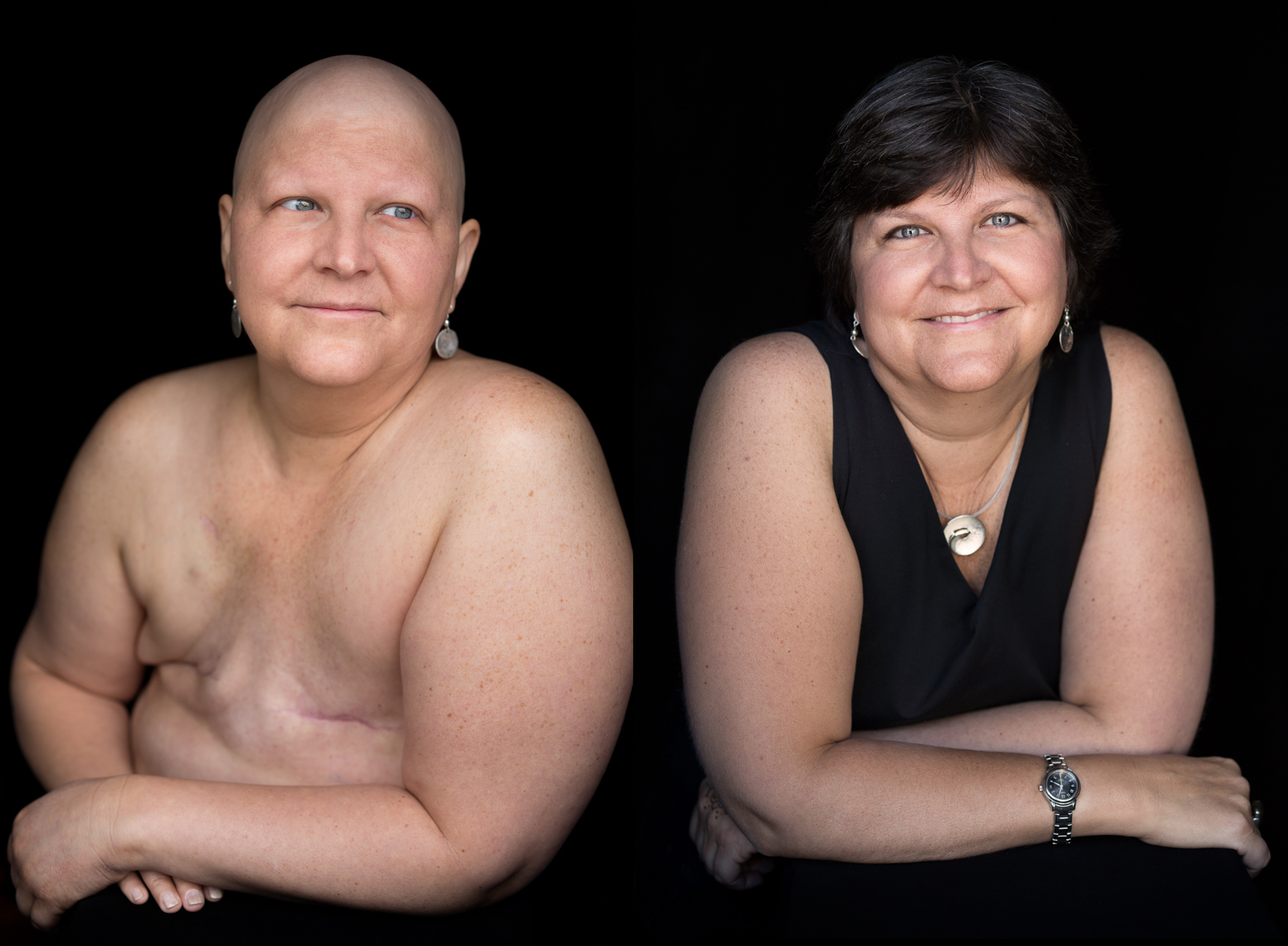 Facing Chemo Before and After - a photographic exhibit examing the effects of chemotherapy - by healthcare photographer Robert Houser