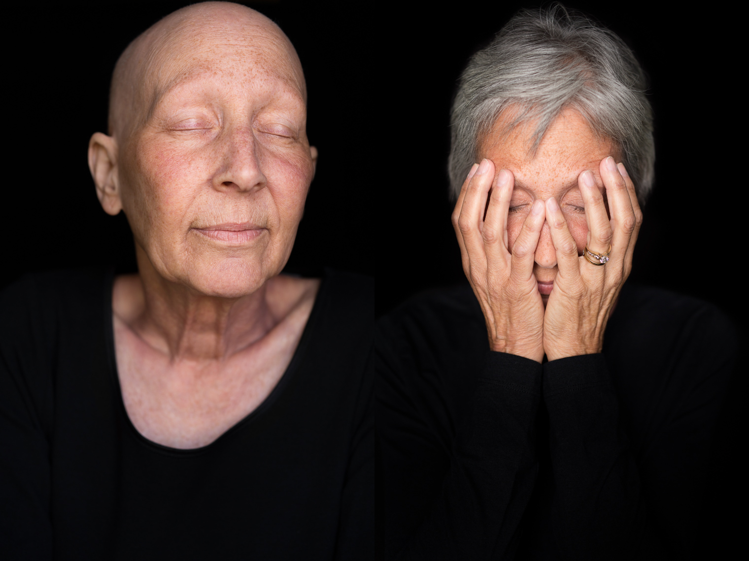 Facing Chemo Before and After - a photographic exhibit examing the effects of chemotherapy - by healthcare photographer Robert Houser